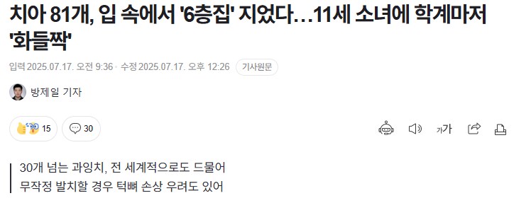 치아 81개, 입 속에서 '6층집' 지었다…11세 소녀에 학계마저 '화들짝'_1.png