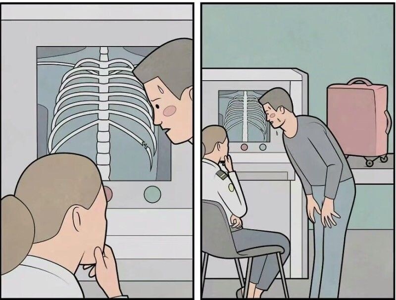 ???: "이거 제 갈비뼈 아닌데요!"_1.jpg