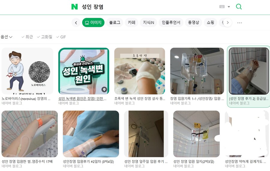 어릴 때 걸렸을 때와 나이 들어서 걸렸을 때 체감 차이 엄청난 질환_3.jpg