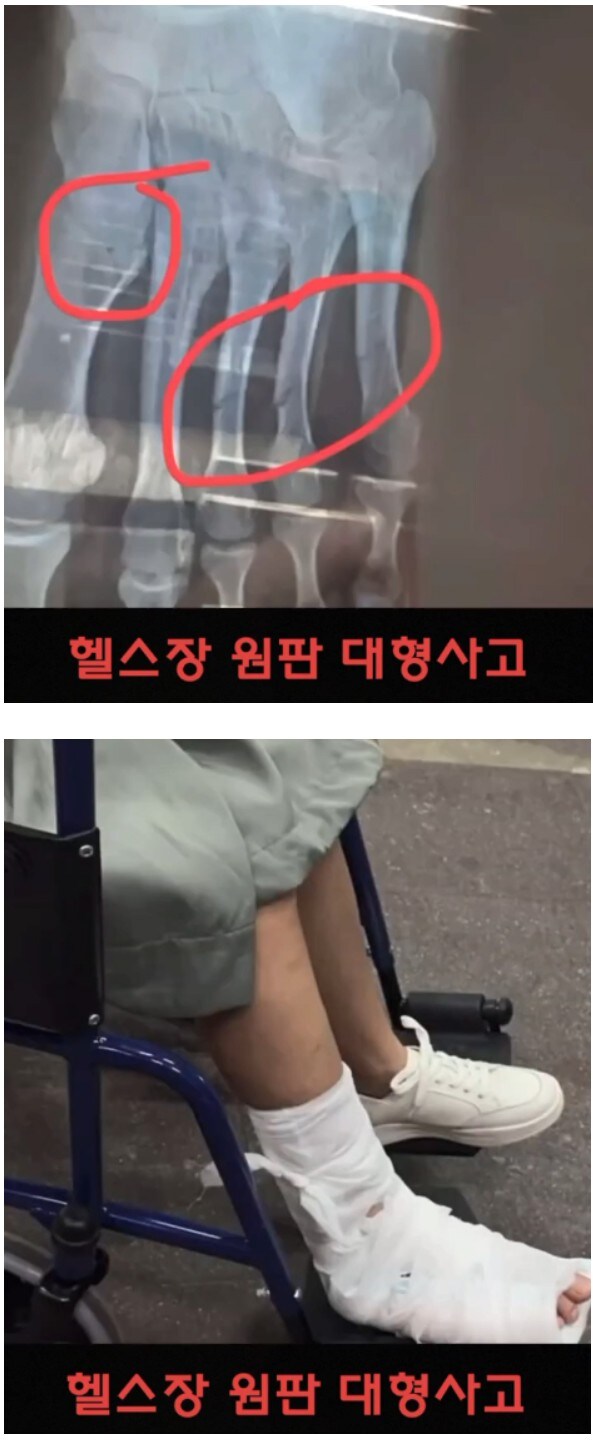 약혐) 헬스장에서 원판에 깔린 사고.mp4_1.jpg