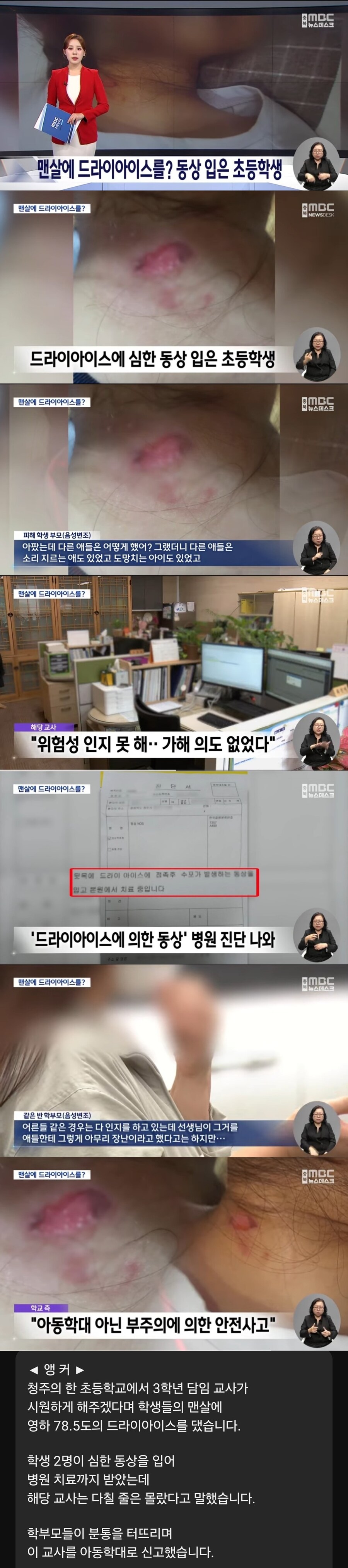 "시원하게 해주겠다" 초등학생 맨살에 드라이아이스 댄 교사_1.jpg