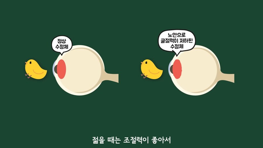 안과 의사들이 안경을 쓰는 이유.jpg_15.png