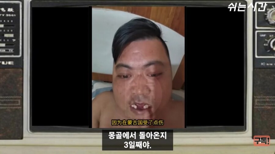 자연사 할뻔 하다 간신히 살아돌아온 중국인_4.jpg