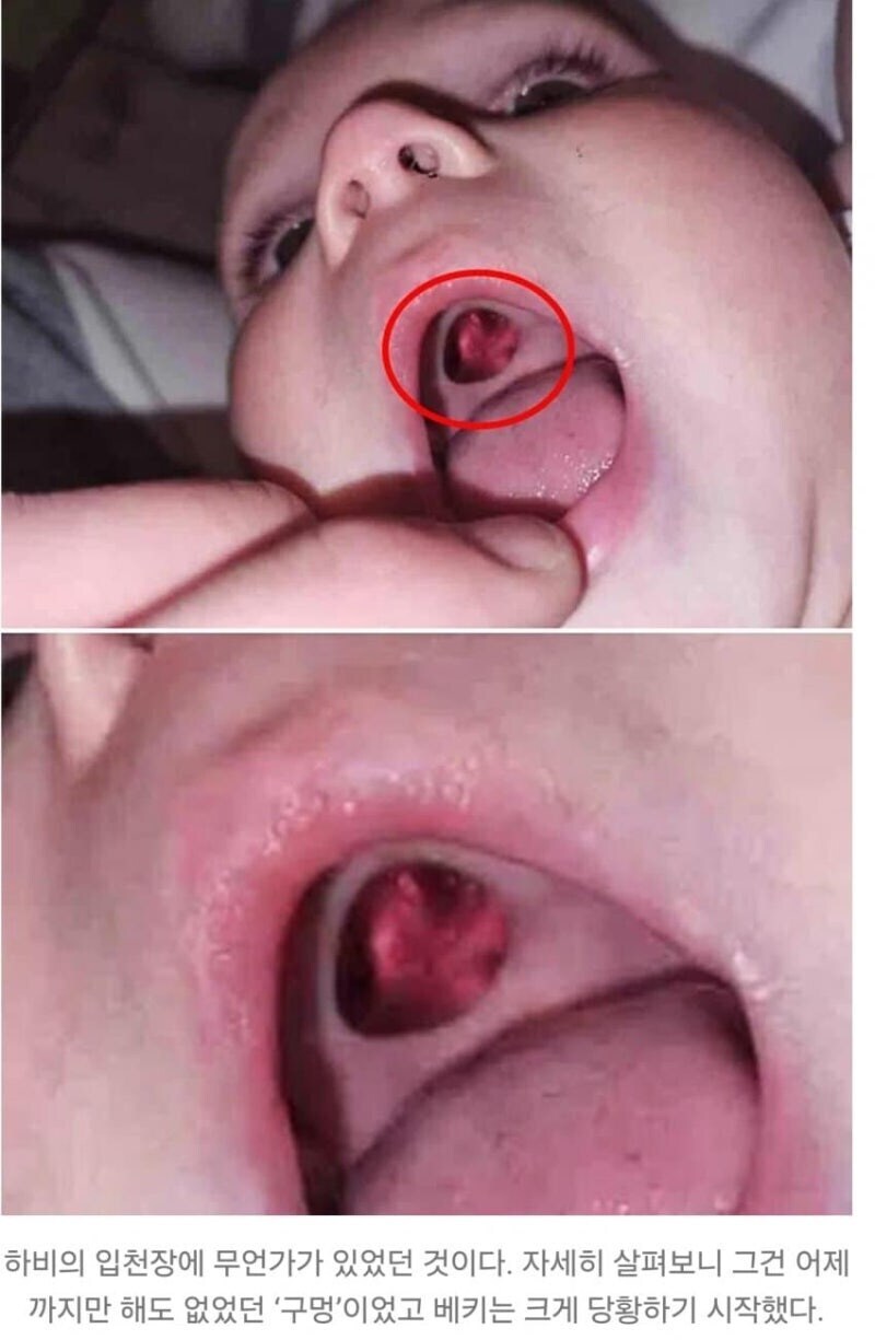 아기 입천장에 구멍이 뚫린 줄 알고 식겁한 엄마_1.jpg