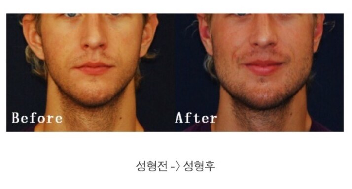 동서양이 확실히 갈린다는 외모 선호 부위_2.png