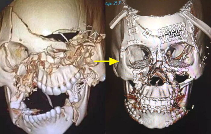혐주의) 현대 의학이 정말 대단한 이유_3.jpg