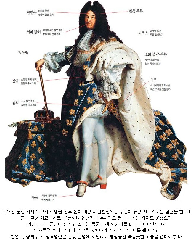 다이아몬드의 저주를 이겨낸 왕_2.png