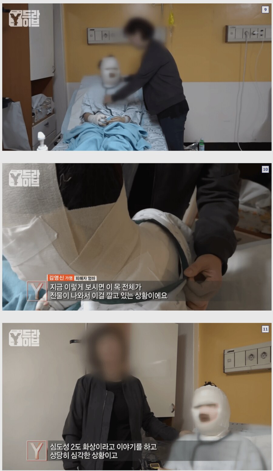 룸메이트 얼굴에 끓는 라면을 부음_1.png