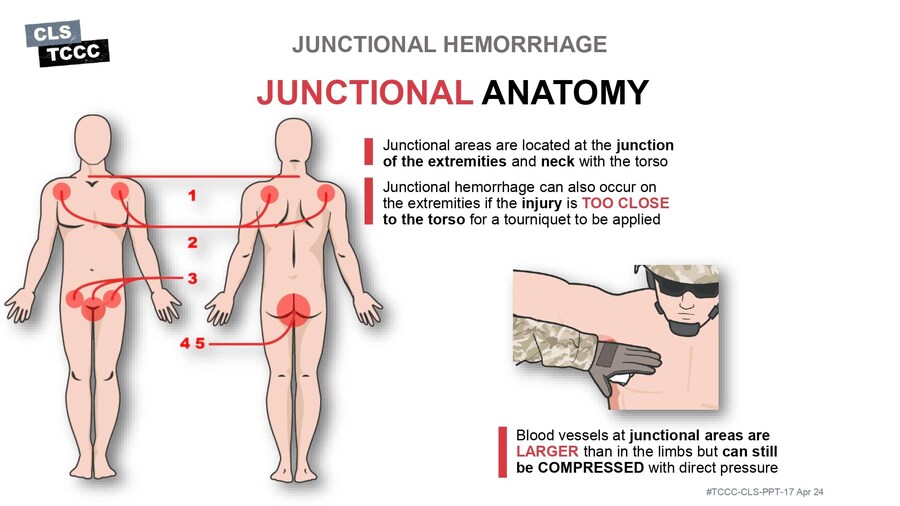 혐?) 피를 멈추는 방법_6.jpg