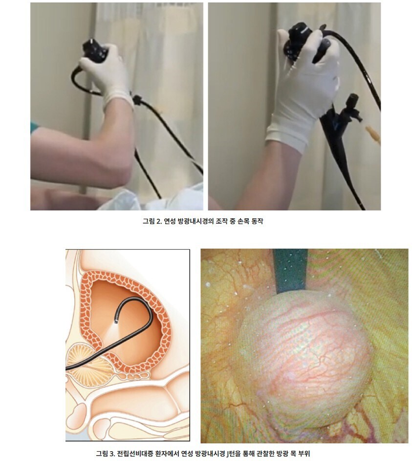 약혐) 아파보이지만 안 아프다고 주장하는 내시경.jpg_1.jpg