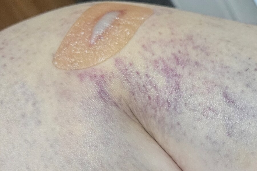 베스트 마라톤기록 실제로 가능함. 내가 직접 해봤음(인증)_7.jpg