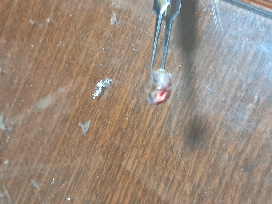 혐) 야심한 새벽에 쥐젖 잘랐다_4.jpg