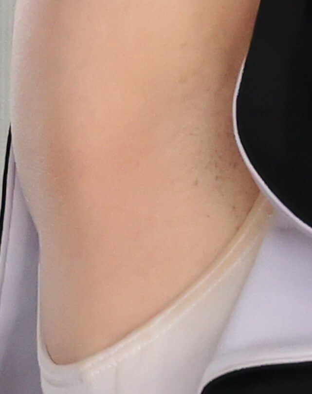 호불호 있는 겨드랑이 상태_11.jpg