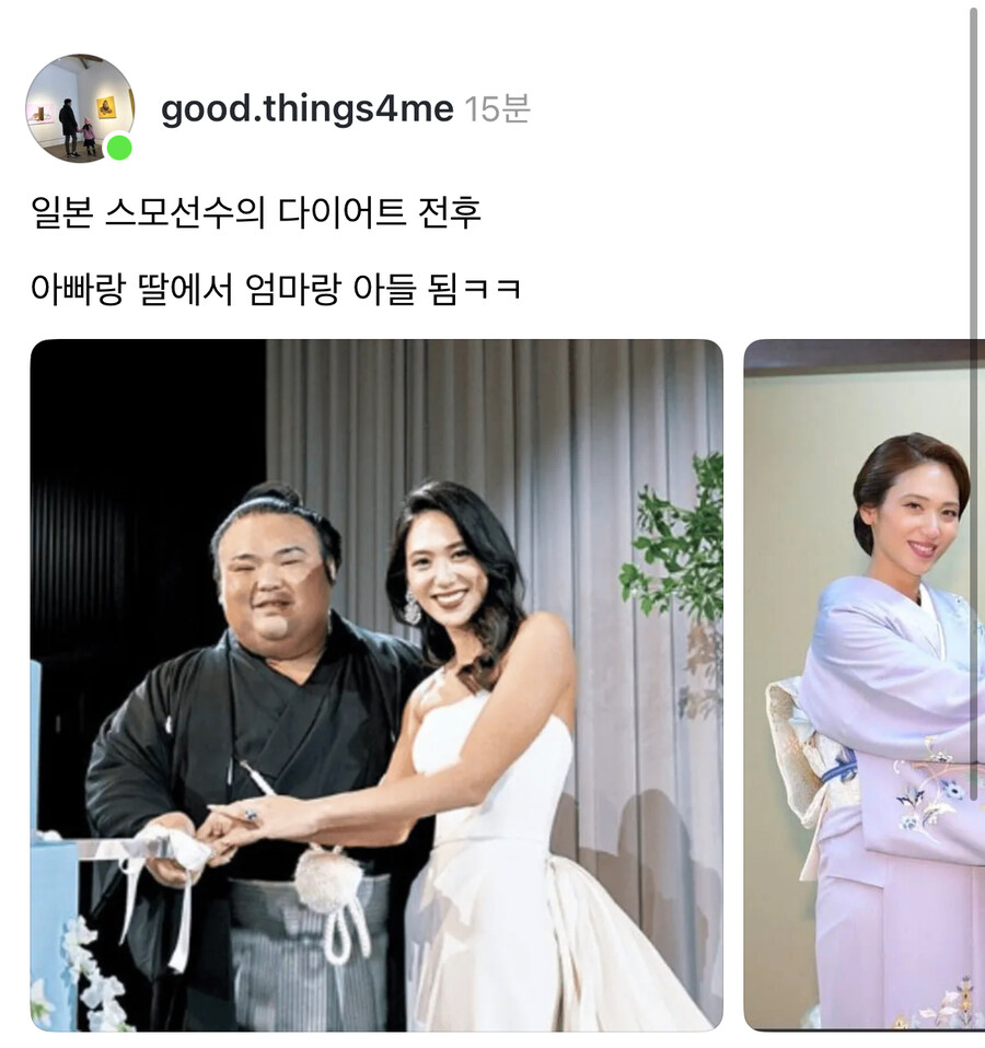 일본 스모 선수 다이어트 전후.jpg_1.jpg