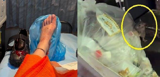 도쿄에 쥐 바글바글, 신주쿠에서 관광객이 쥐한테 발 물림_1.jpg