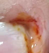 혐) 유게이의 피와 땀_3.jpg