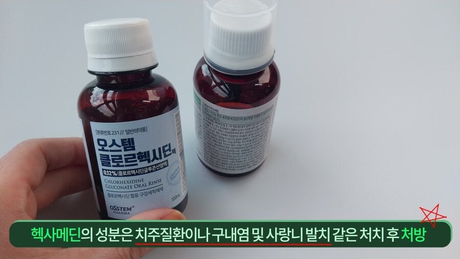 컨디션 최악일 때 면역력 떨어져 갑자기 잇몸 부었을 경우_2.jpg