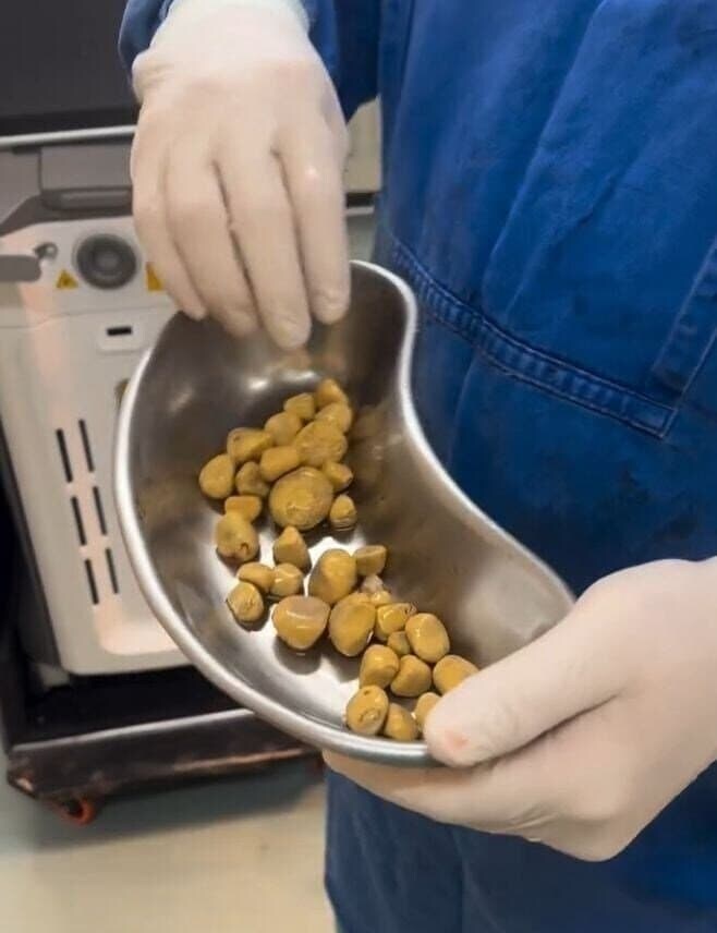 콜라를 물처럼 마시면 생기는 일_2.jpg