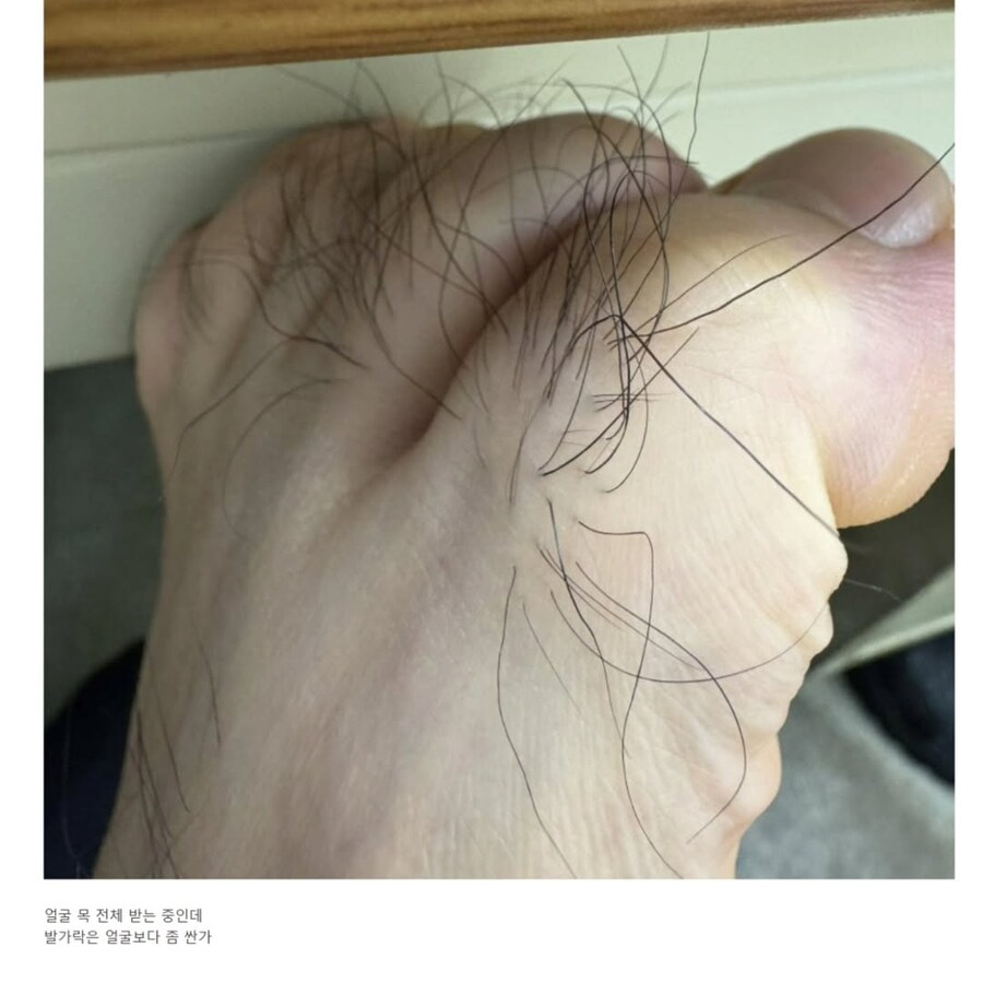 (혐) 발가락털도 제모 되냐는 디시인.jpg_1.jpg