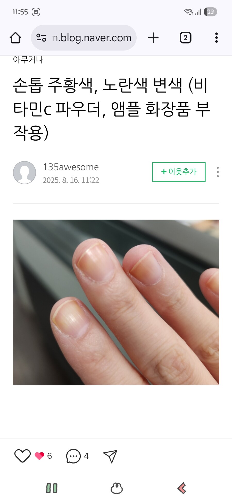 헐 병걸린줄 알았네.._1.jpg
