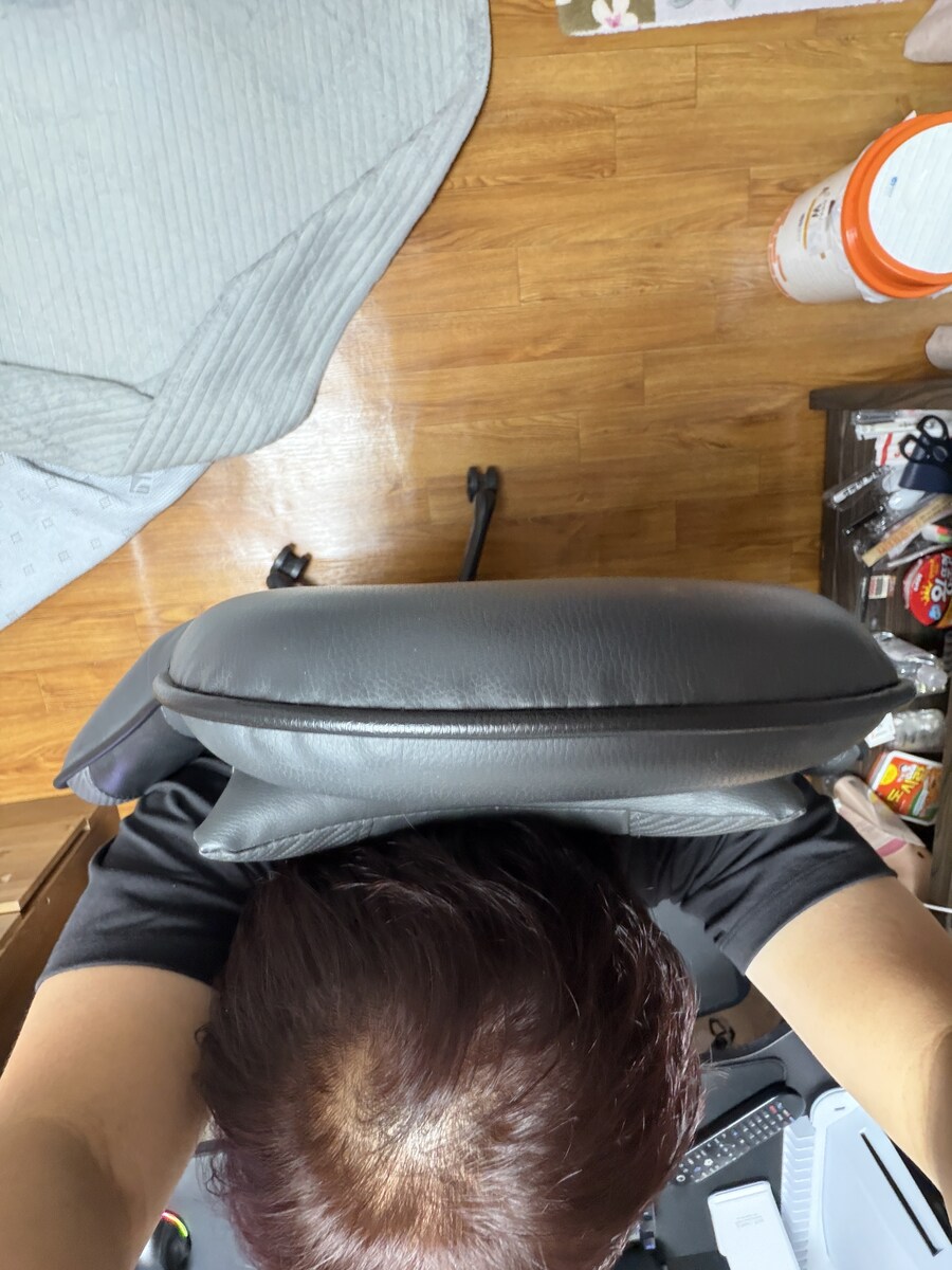 제머리 탈모인것같은데...약먹는게 좋을까요?_1.jpg
