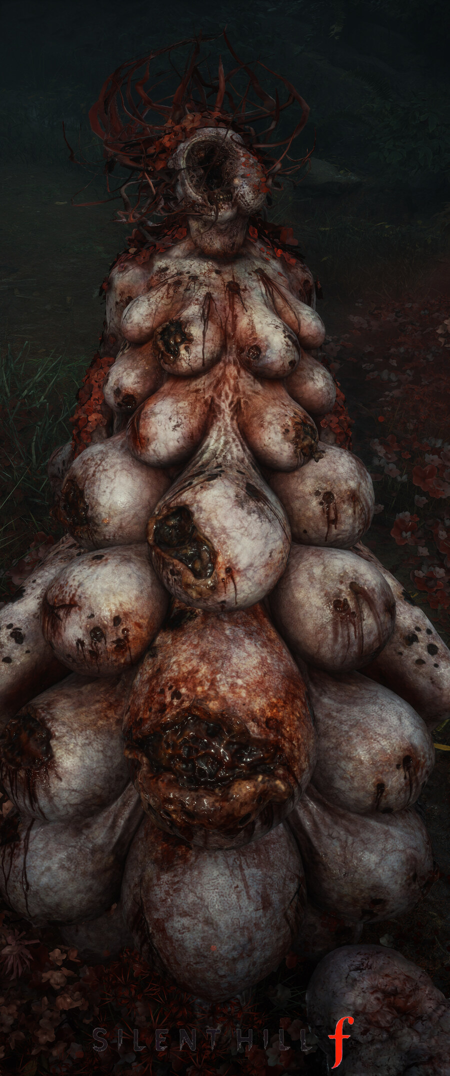 사일런트 힐 f.jpg_10.jpg