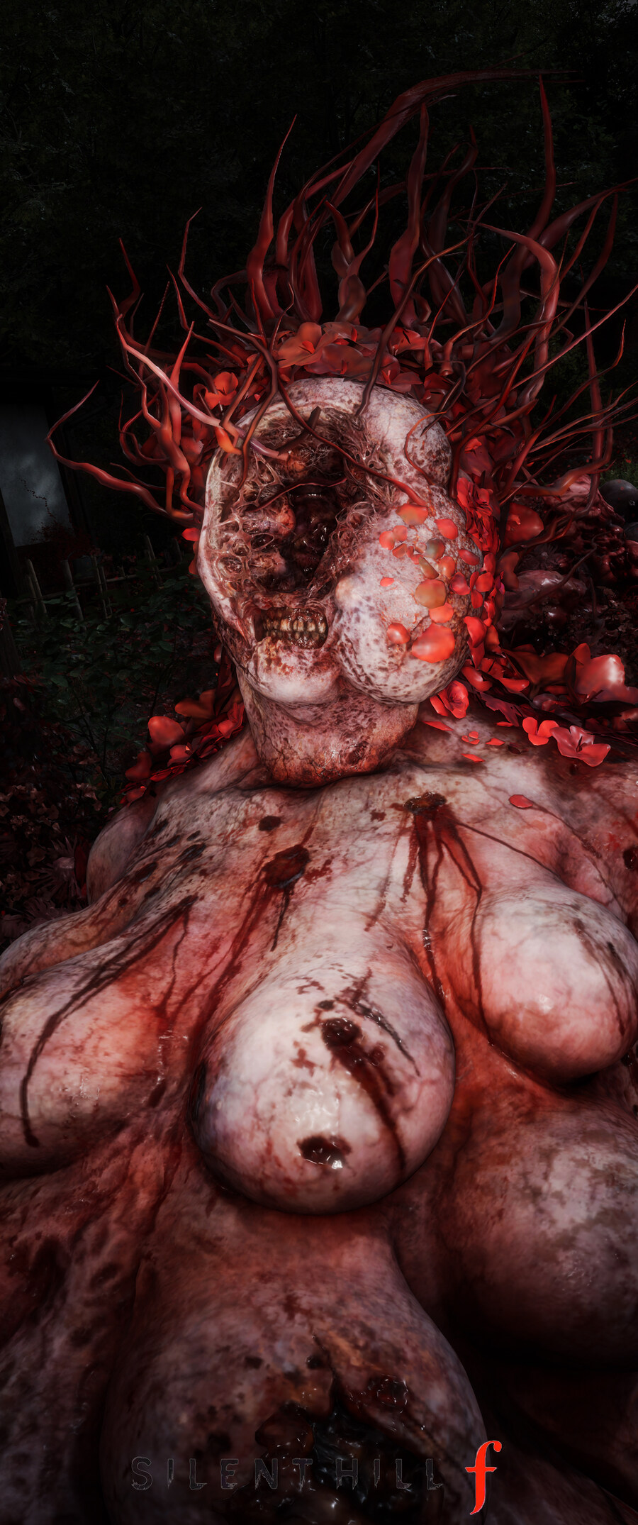 사일런트 힐 f.jpg_25.jpg