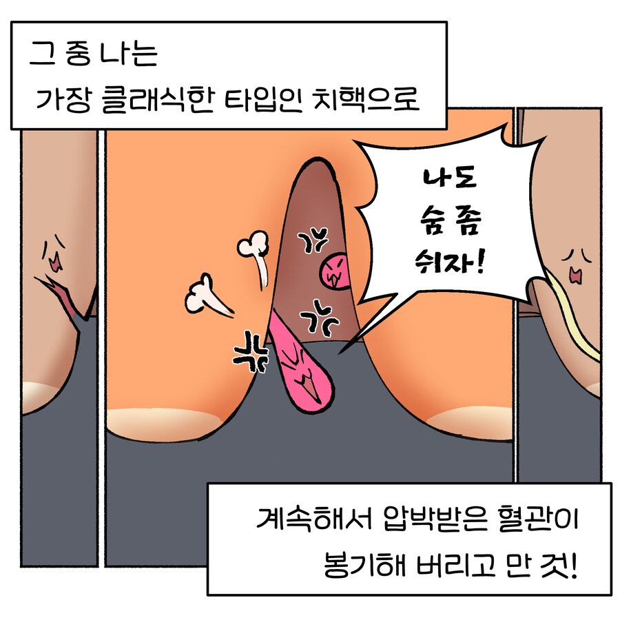 위기의 치질수술 1~3_13.png