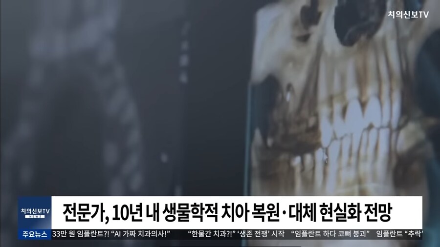 인간치아 재배 성공, 임플란트 사라진다_3.jpg