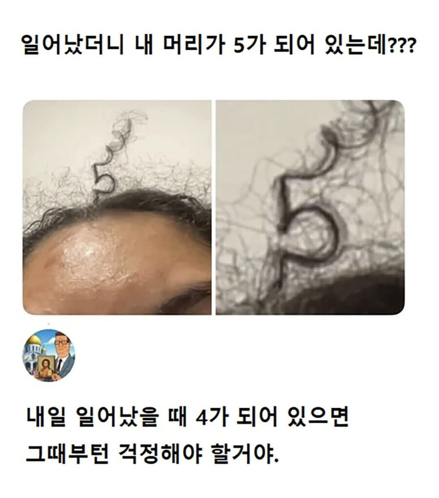 일어났더니 머리가..._1.jpg