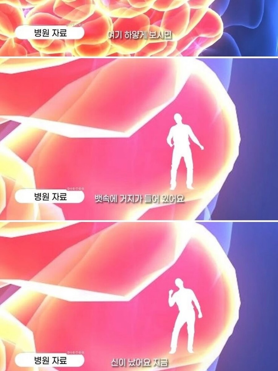 돼지들이 원하는건 위고비 마운자로가 아니다.jpg_2.jpg