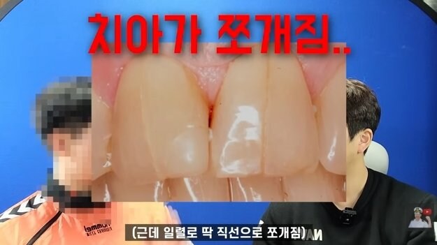 잠수함을 타면 겪는 신체적 변화.jpg_10.jpg