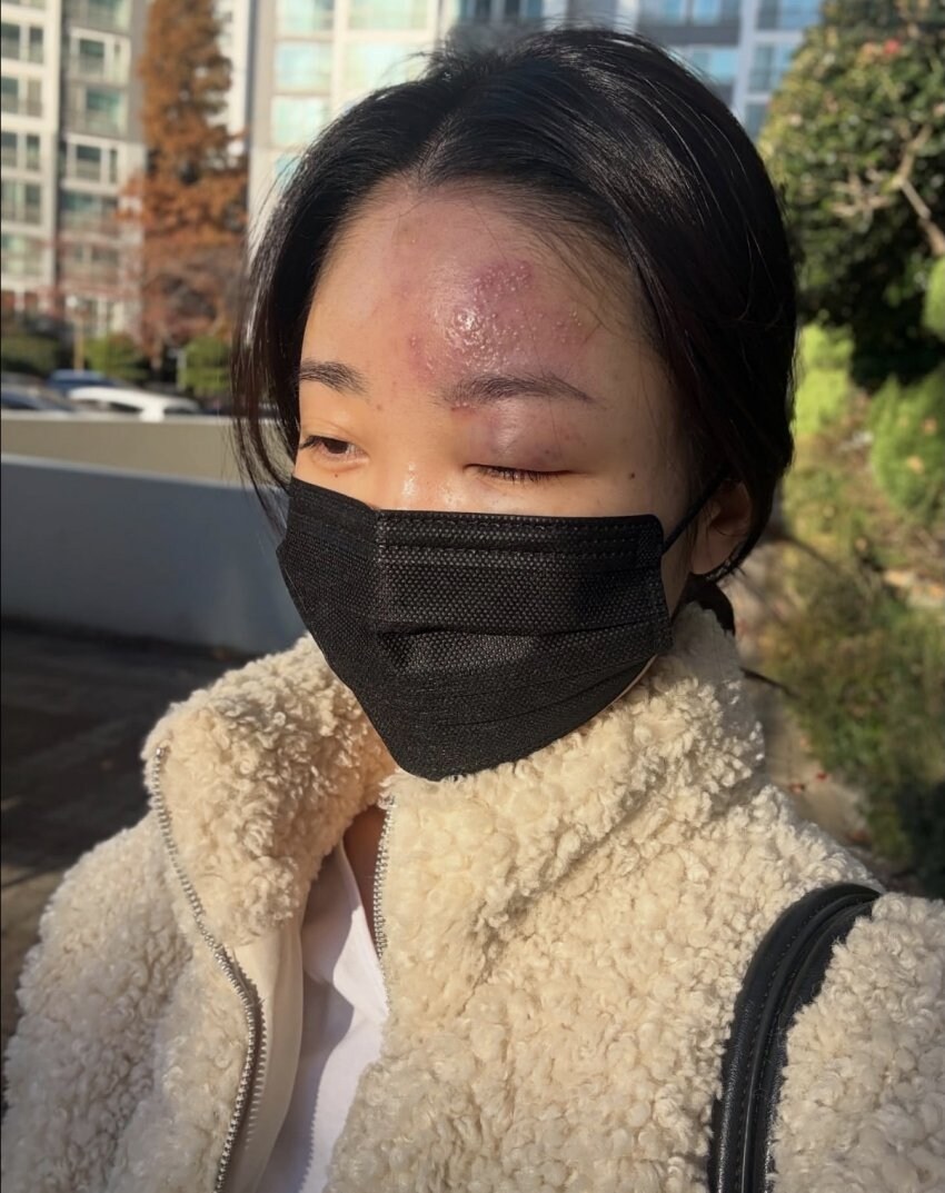 현재 스레드에서 난리난 의료사고.....jpg_2.jpg