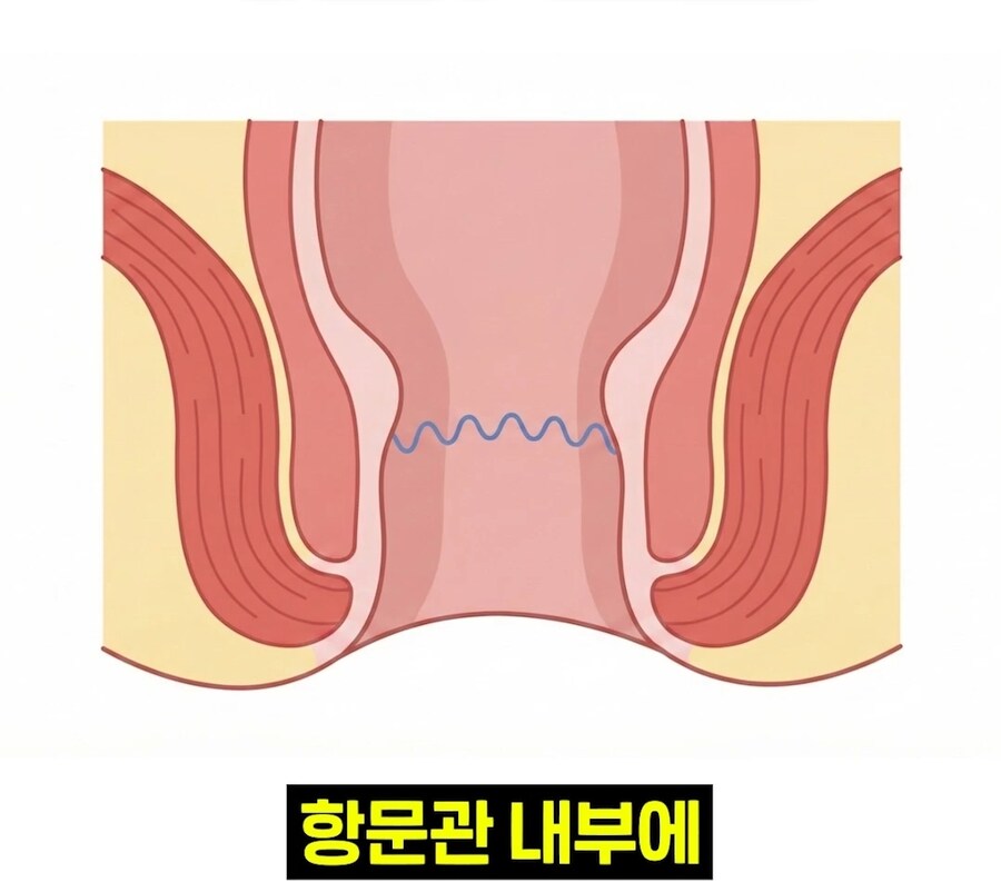 우리 뇌가 방구랑 된장을 구분하는 법_9.jpg