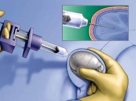 노벨피아) 남존여비 소설들 읽는데 계속 신경쓰이는것_2.jpg
