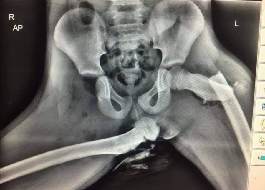 자동차 대시보드에 다리를 올리면 안 되는 이유 (약혐주의)_1.jpg