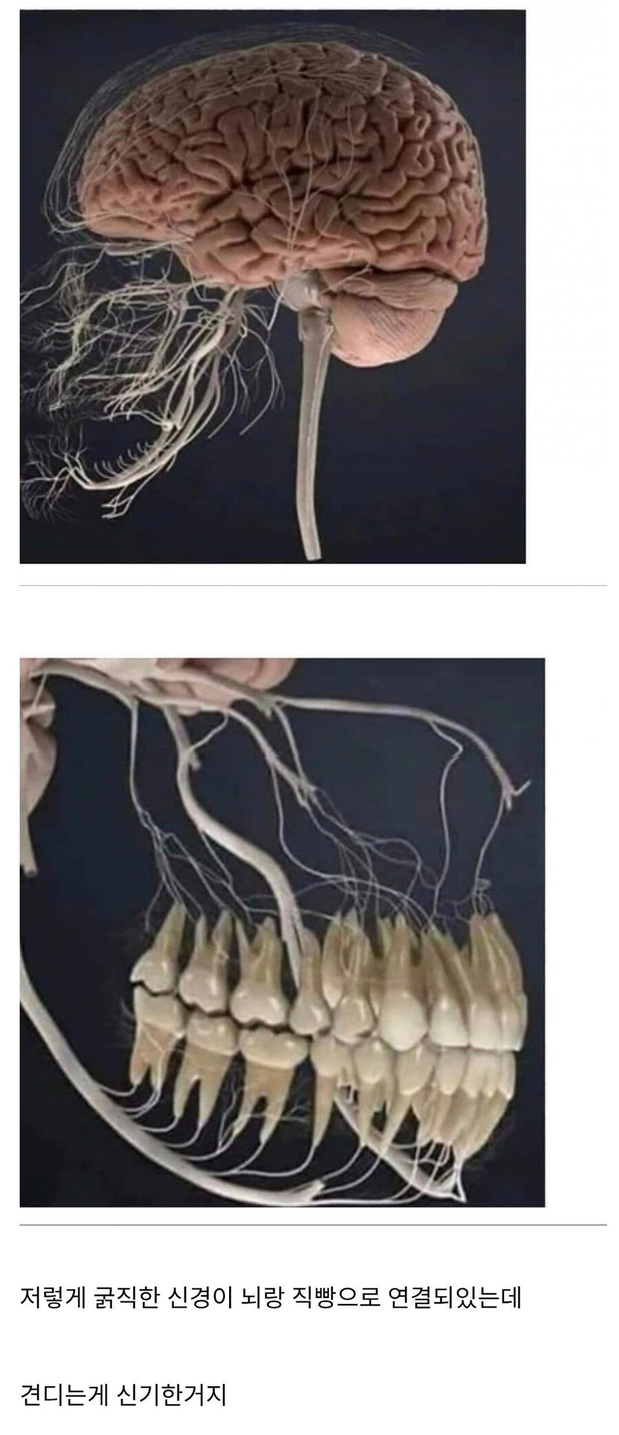 혐)치통이 견디기 힘든 이유.jpg_1.jpg