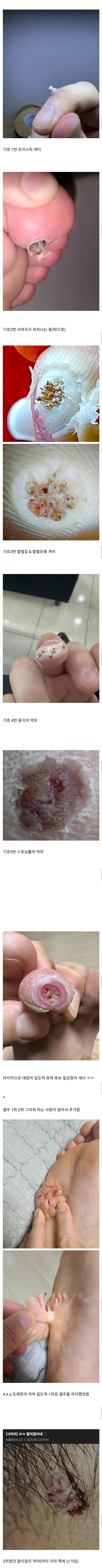 극혐주의) 티눈갤 갤주 대결 모음_2.jpg