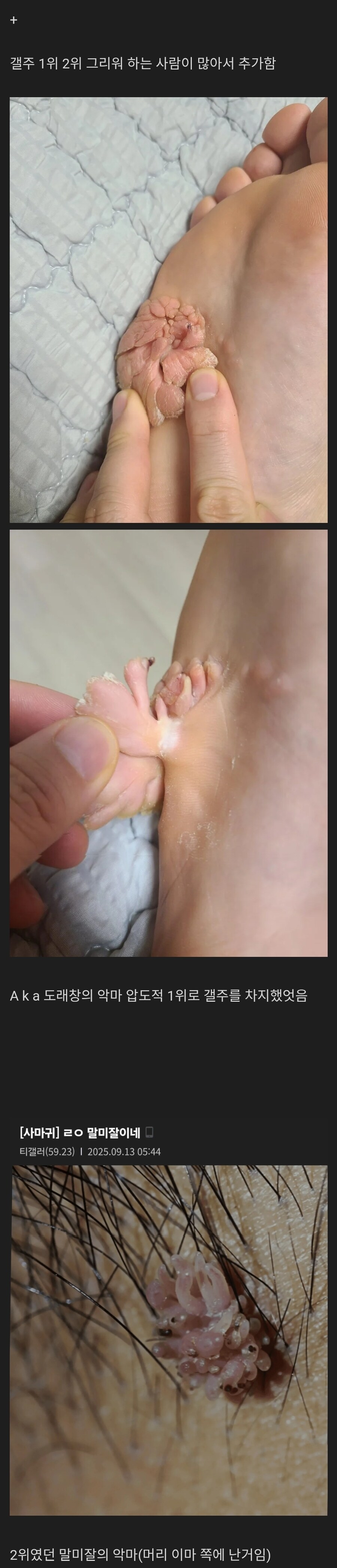 극1혐)25년도 티눈갤 갤주 선정.jpg_2.jpg