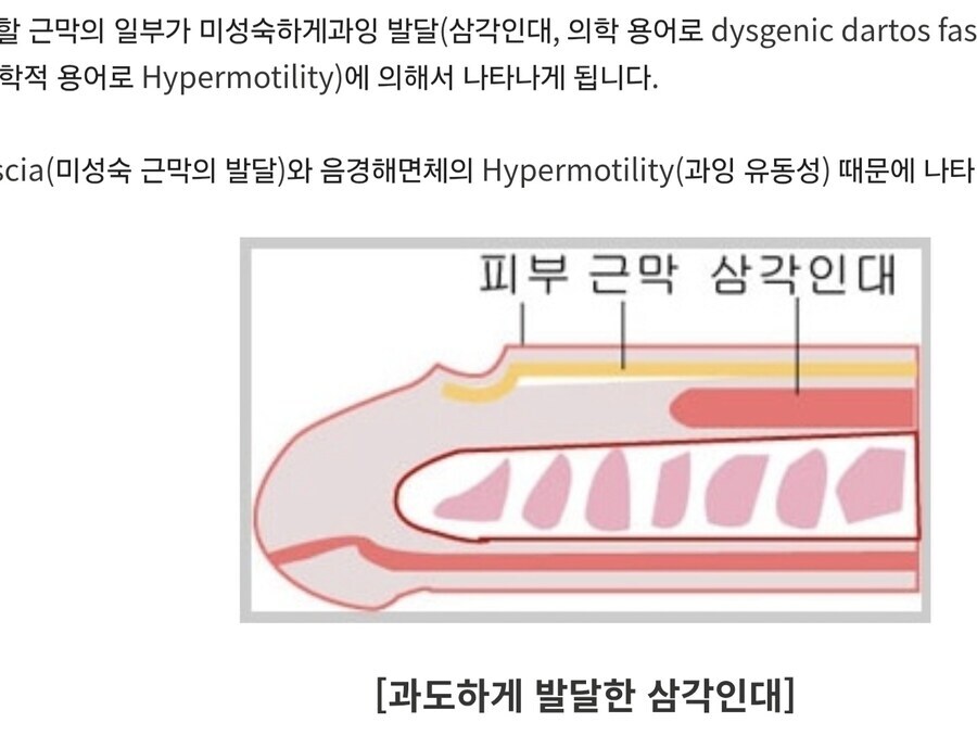남자에게만 있는 함몰증세_1.jpg