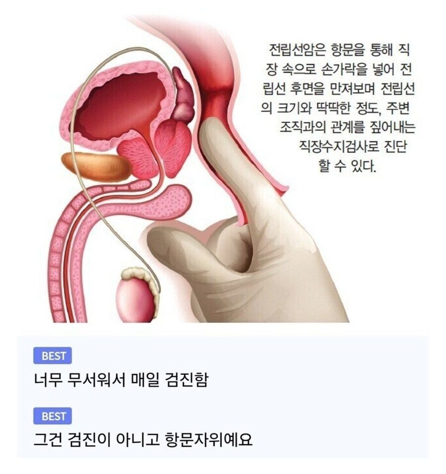 전립선 조심 하셈_1.jpg