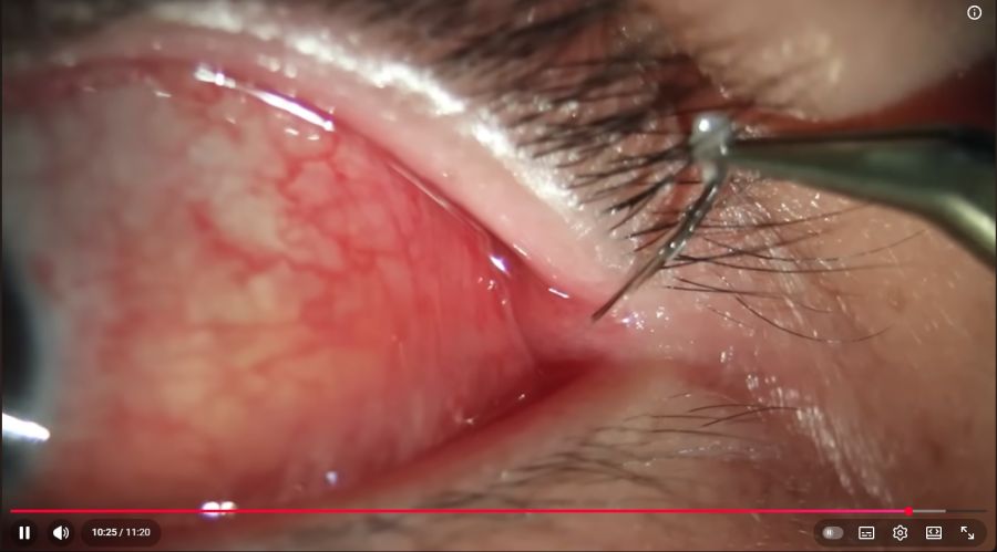 (약후방혐)유게인들도 인정할 저주급 매몰모[毛]_2.png