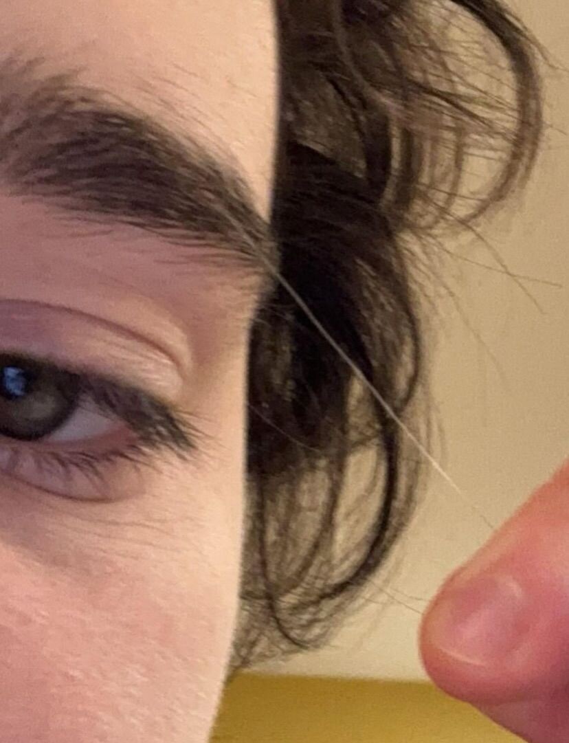 가끔 얼굴이나 몸 만질때 잡히는 그거_2.jpg