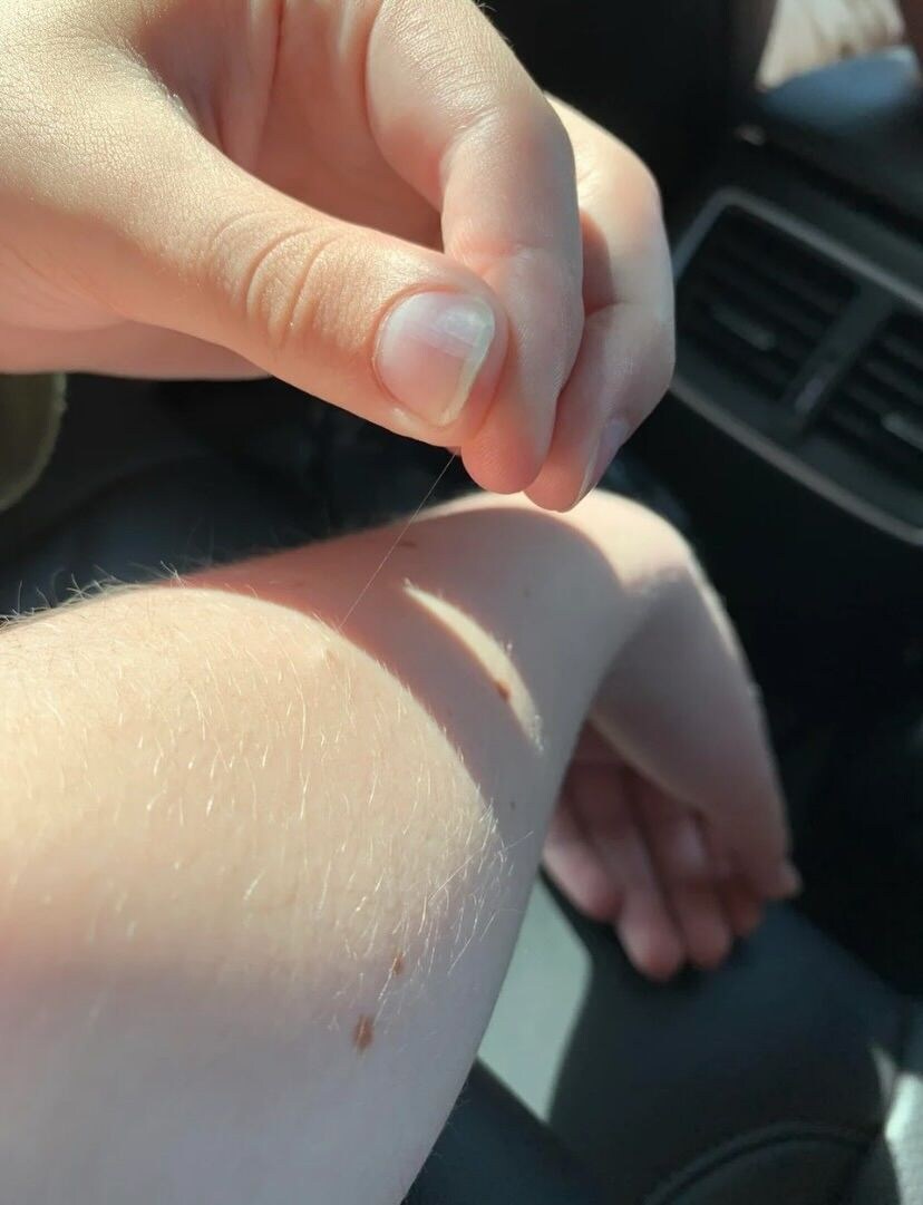 가끔 얼굴이나 몸 만질때 잡히는 그거_3.jpg