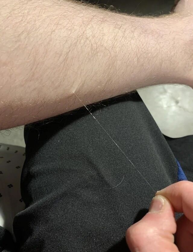 가끔 얼굴이나 몸 만질때 잡히는 그거_4.jpg