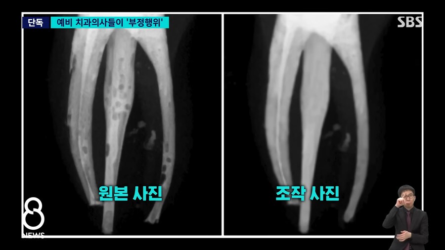 예비 의사들의 놀라운 '포토샵'…"잘 해보려고" 연세대 또 '발칵'_5.png