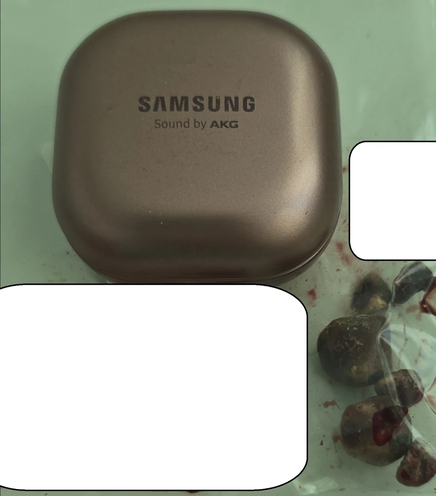 쓸개빠진 으른양 입퇴원후기_2.webp