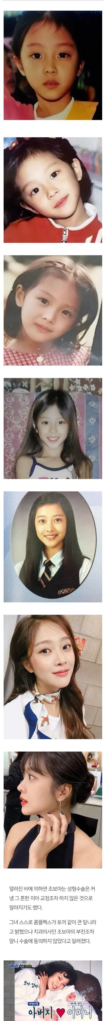 아빠가 절대 성형 못하게 했다는 배우_1.webp