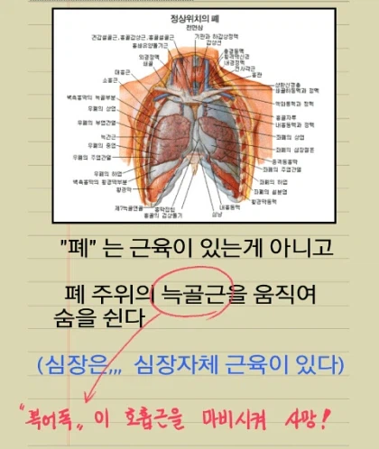 복어 잘못먹었을때 치료 방식_2.webp