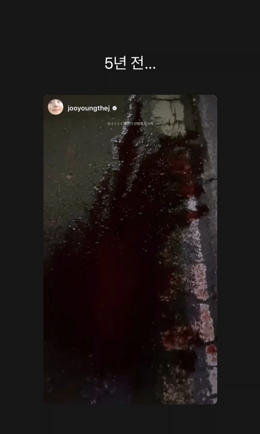 피주의)혐) 코피 때문에 활동중단한 배우 차주영_2.webp